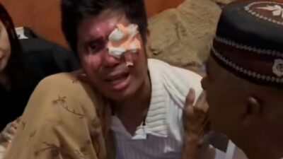 korban penyiraman air keras (foto wartasidoarjo.pikiran-rakyat.com)